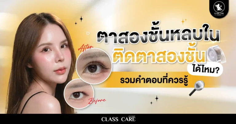 ตาสองชั้นหลบใน ติดตาสองชั้นได้ไหม? รวมคำตอบที่ควรรู้