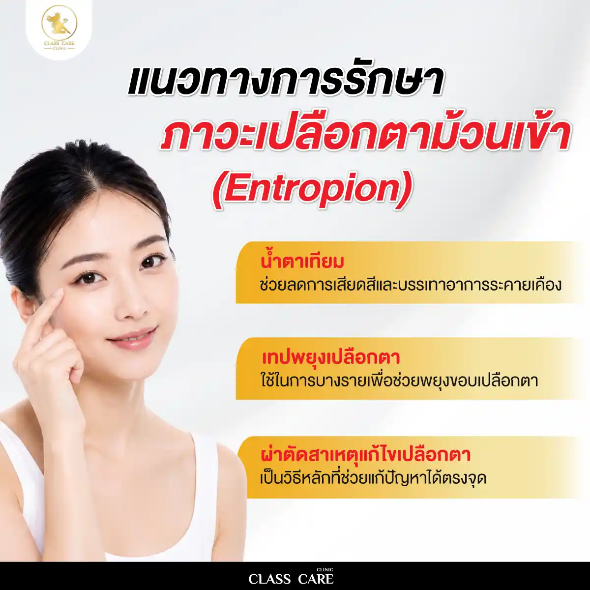 แนวทางการรักษาภาวะเปลือกตาม้วนเข้า
