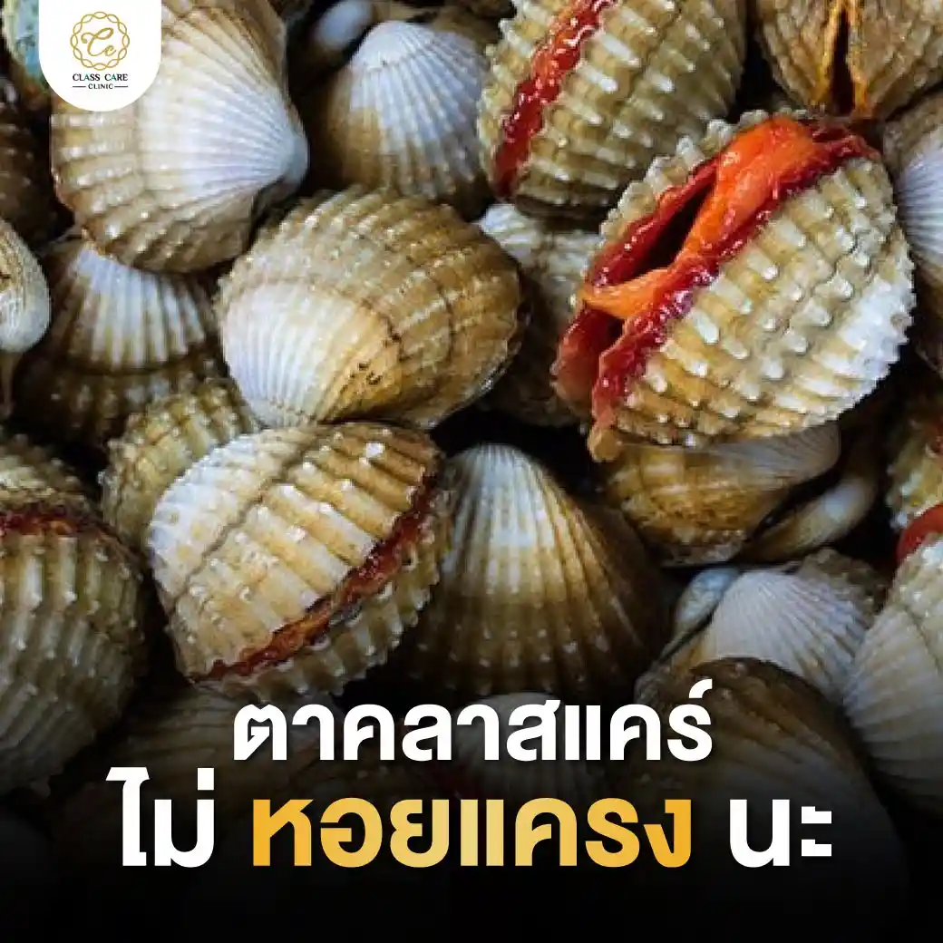 วิธีแก้ปัญหาตาหรอยแครง