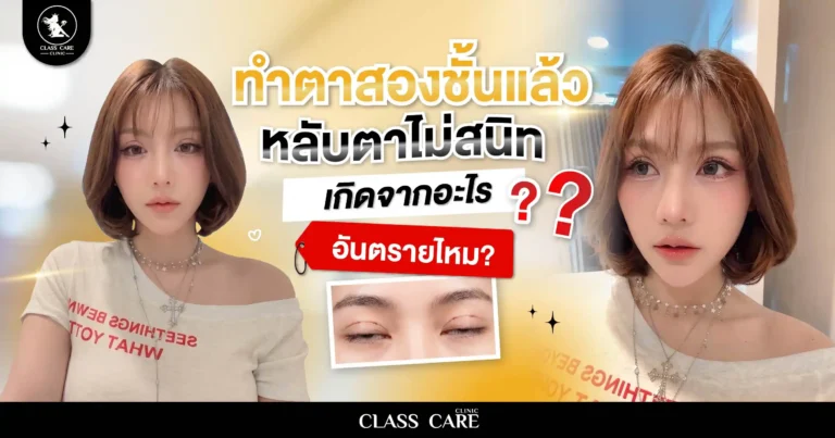 ทำตาสองชั้นแล้วหลับตาไม่สนิท เกิดจากอะไร อันตรายไหม