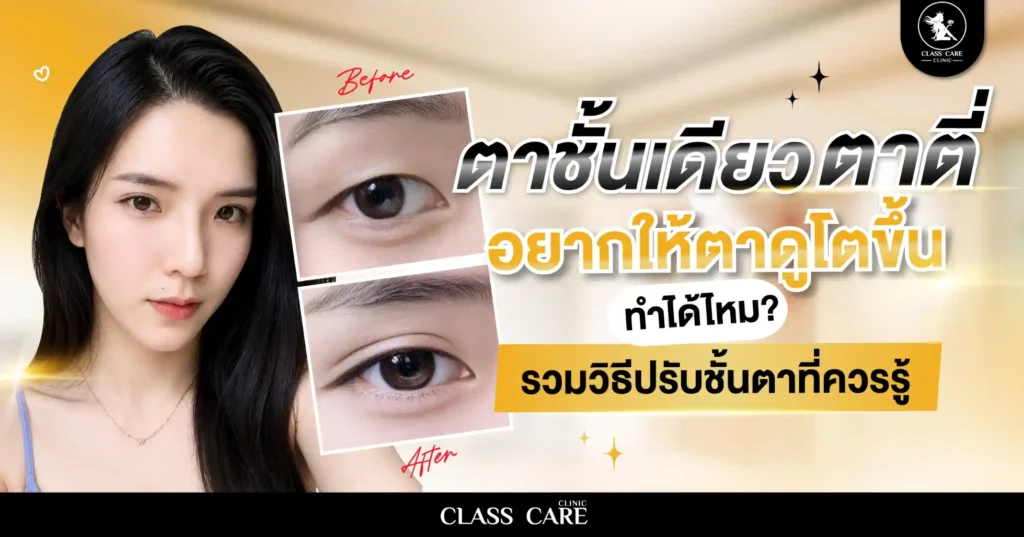 ตาชั้นเดียว ตาตี่ อยากให้ตาดูโตขึ้น ทำได้ไหม? รวมวิธีปรับชั้นตาที่ควรรู้