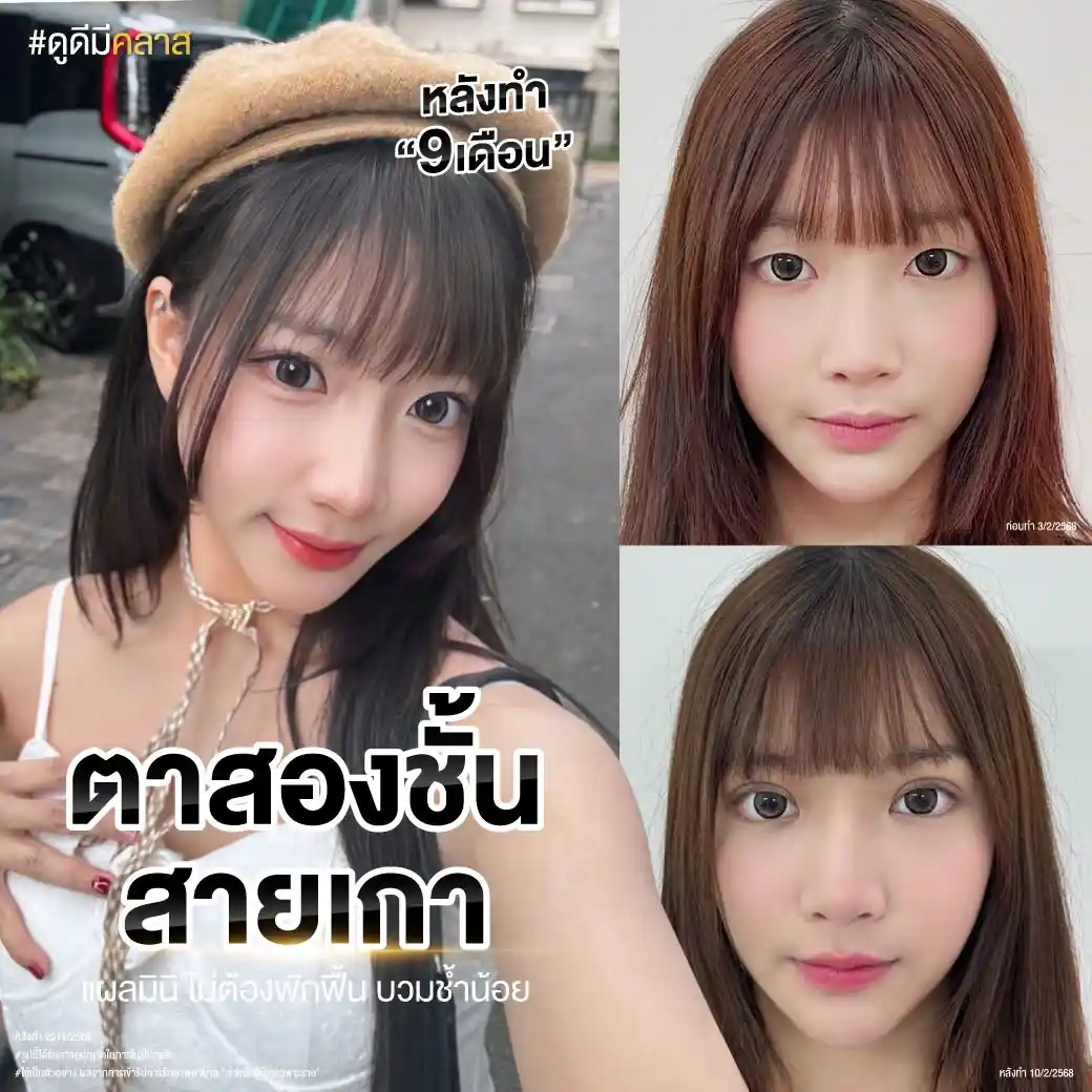 ทรงตาสไตล์เกาหลี คืออะไร