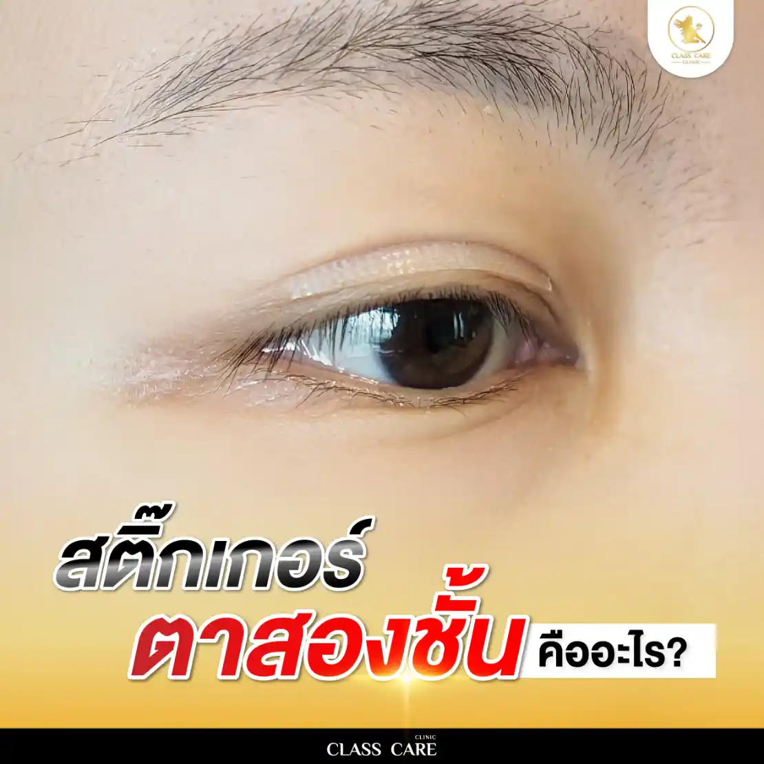 เทปติดตาสองชั้น คืออะไร