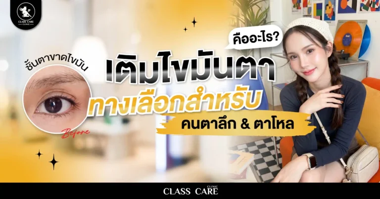 เติมไขมันตา คืออะไร? แนวทางสำหรับคนตาลึกและตาโหล