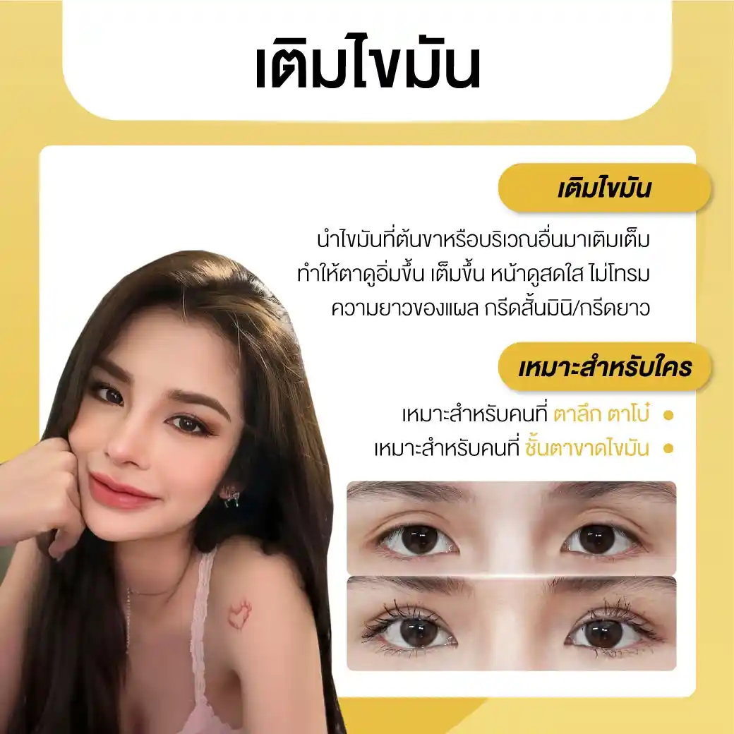 การเติมไขมันตา คืออะไร