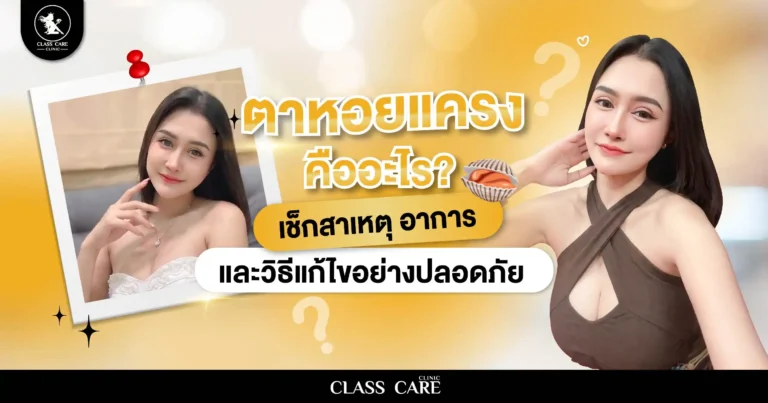 ตาหอยแครง คืออะไร? เช็กสาเหตุ อาการ และวิธีแก้ไขอย่างเหมาะสม