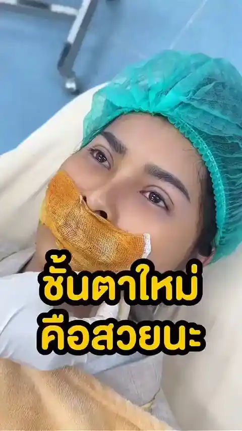 ปกวิดีโอรีวิวตาสองชั้น Classcare Clinic 01