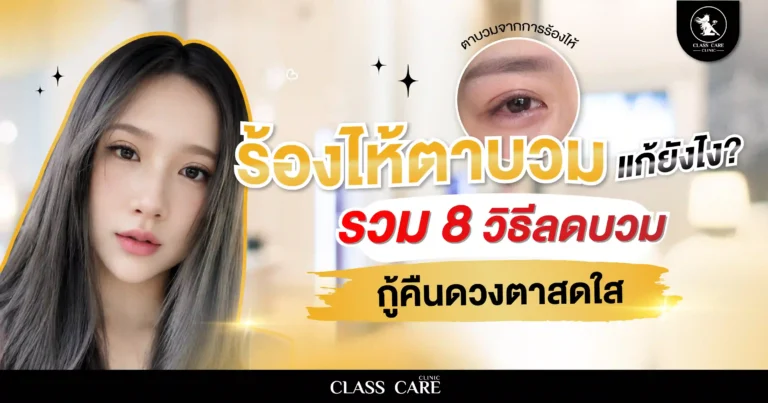 ร้องไห้ตาบวม แก้ยังไง? รวม 8 วิธีลดบวม กู้คืนดวงตาสดใส