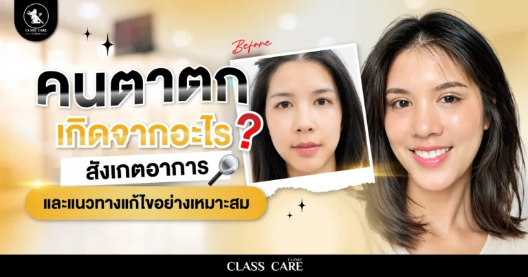 คนตาตกเกิดจากอะไร? สังเกตอาการและแนวทางแก้ไขอย่างเหมาะสม