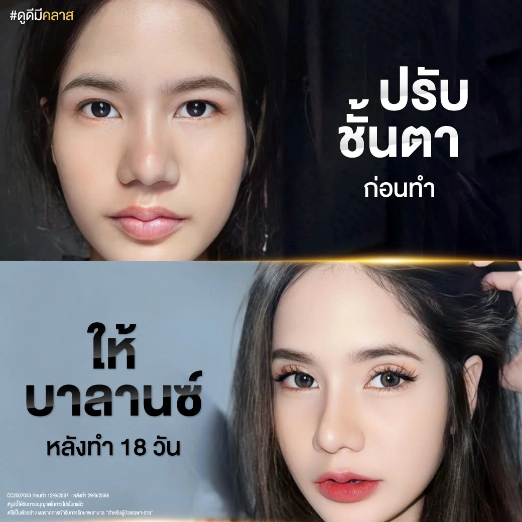 การรักษาและแก้ไขปัญหาคนตาตก