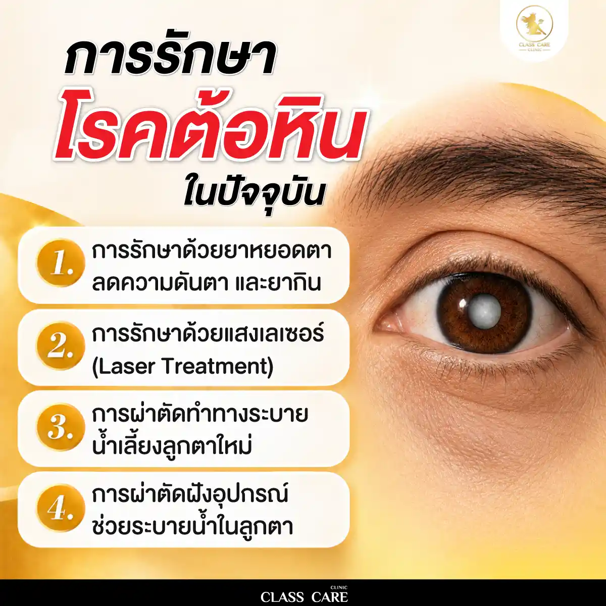 การรักษาโรคต้อหินในปัจจุบัน