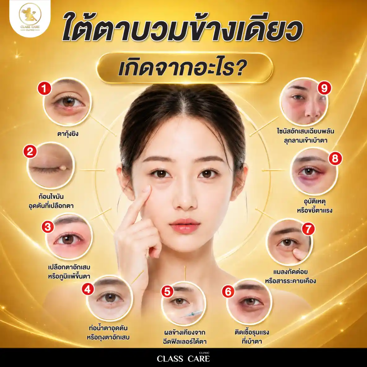 ใต้ตาบวมข้างเดียว เกิดจากอะไร
