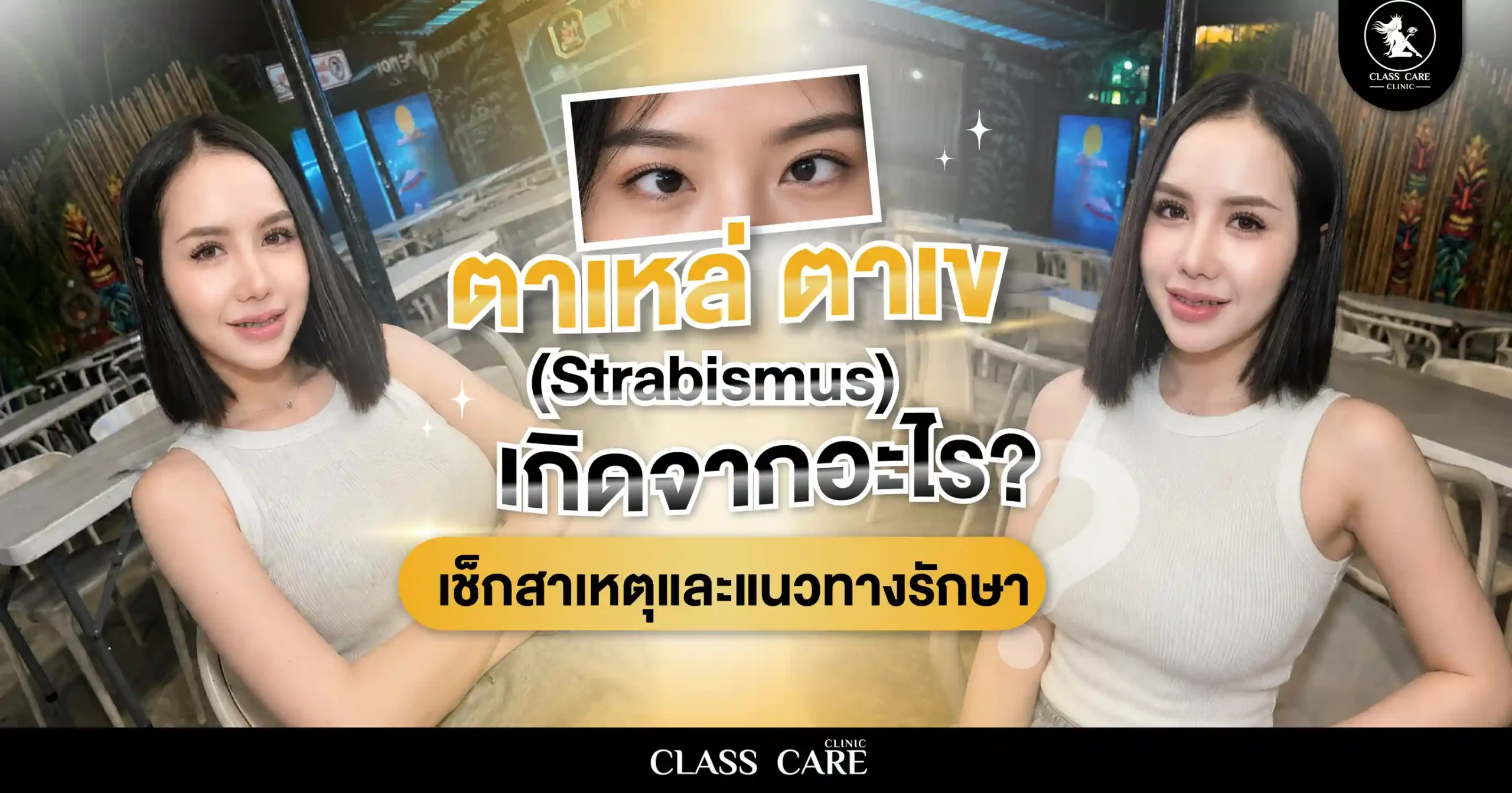 ตาเหล่ ตาเข (Strabismus) เกิดจากอะไร? เช็กสาเหตุและแนวทางรักษา