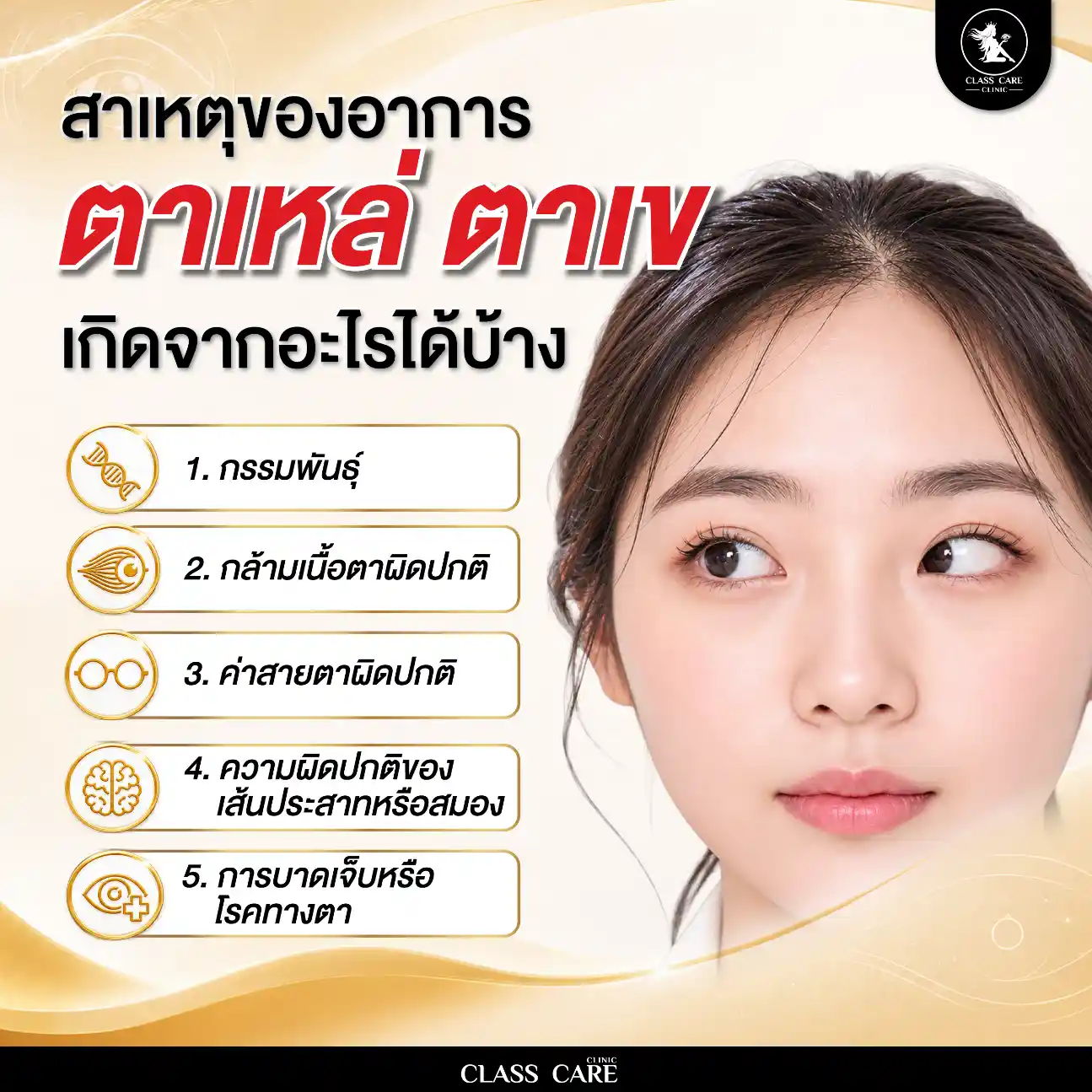 สาเหตุของอาการตาเหล่ ตาเข เกิดจากอะไรได้บ้าง