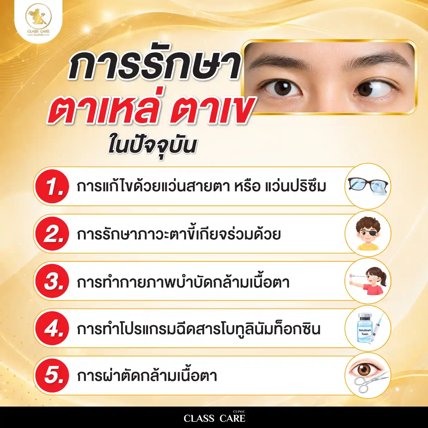 การรักษาตาเหล่ ตาเข ในปัจจุบัน