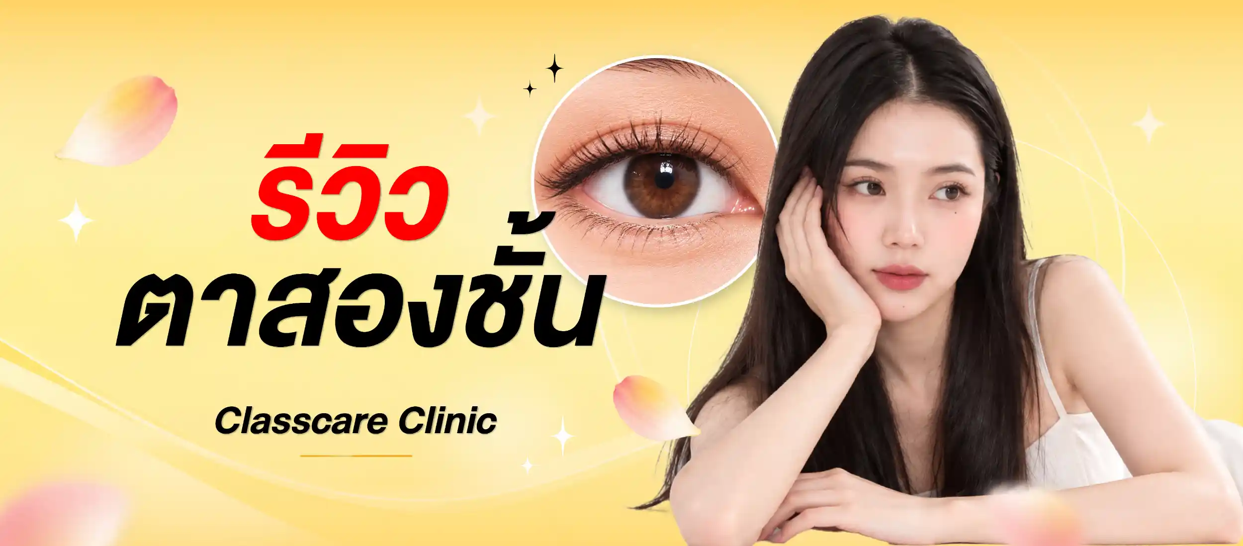 ปกรีวิวตาสองชั้น Classcare Clinic