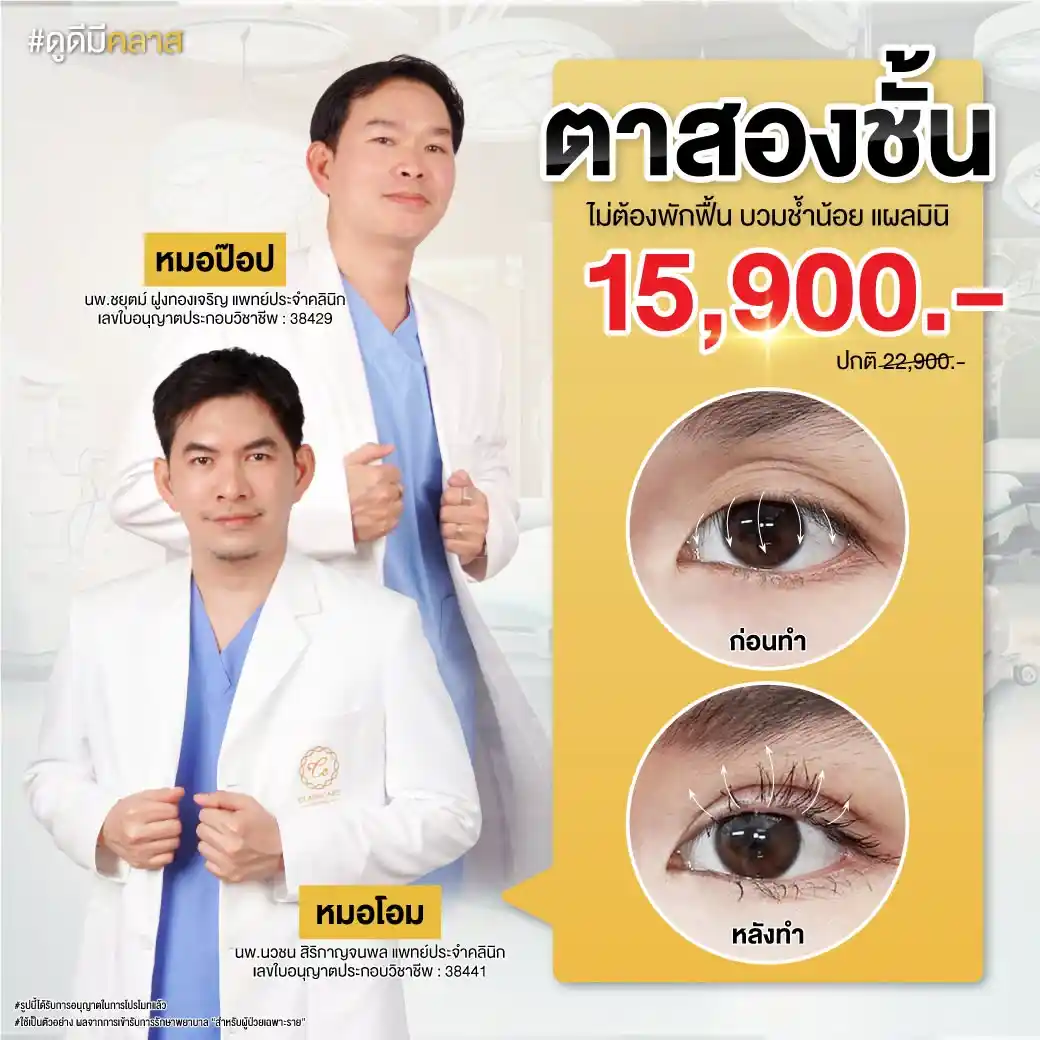 ราคาตาสองชั้น ที่ Classcare Clinic
